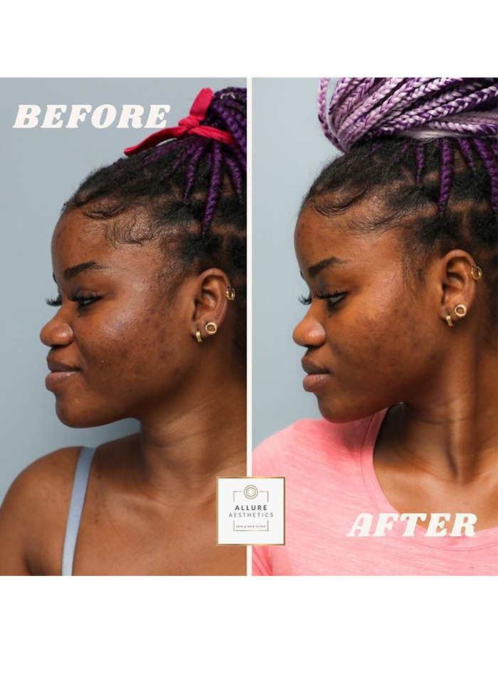 Allure Aesthetics Skin and Hair Clinic in Dar es salaam - Tanzania – WhizzTanzania